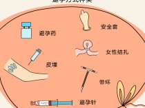 女人 *** 有几种方法（女人避孕有几种方法）